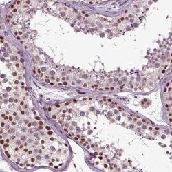 CoREST3/RCOR3 Antibody, Novus Biologicals 25ul; Unconjugated:Antibodies,