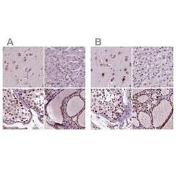 CoREST3/RCOR3 Antibody, Novus Biologicals 25ul; Unconjugated:Antibodies,