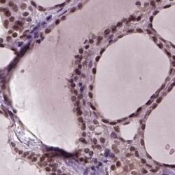CoREST3/RCOR3 Antibody, Novus Biologicals 25ul; Unconjugated:Antibodies,