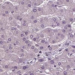 CoREST3/RCOR3 Antibody, Novus Biologicals 25ul; Unconjugated:Antibodies,