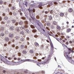 CoREST3/RCOR3 Antibody, Novus Biologicals 25ul; Unconjugated:Antibodies,