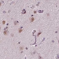 CoREST3/RCOR3 Antibody, Novus Biologicals 25ul; Unconjugated:Antibodies,