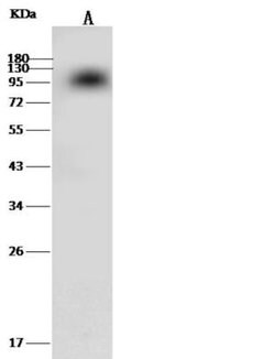 Coagulation Factor II/Thrombin Rabbit anti-Mouse, Clone: 318, Novus Biologicals:Antibodies:Primary