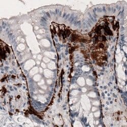 Coagulation Factor III/Tissue Factor Antibody (CL3807), Novus Biologicals:Antibodies:Primary