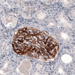 Coagulation Factor III/Tissue Factor Antibody (CL3807), Novus Biologicals:Antibodies:Primary