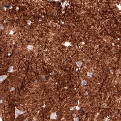 Coagulation Factor III/Tissue Factor Antibody (CL3807), Novus Biologicals:Antibodies:Primary