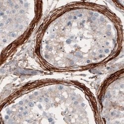 Coagulation Factor III/Tissue Factor Antibody (CL3807), Novus Biologicals:Antibodies:Primary