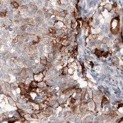Coagulation Factor III/Tissue Factor Antibody (CL3807), Novus Biologicals:Antibodies:Primary