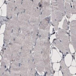 Coagulation Factor III/Tissue Factor Antibody (CL3807), Novus Biologicals:Antibodies:Primary
