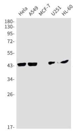 Coagulation Factor III/Tissue Factor Rabbit anti-Human, Mouse, Rat, Clone:
