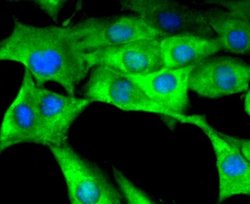 Coagulation Factor III/Tissue Factor Antibody (SN20-16), Novus Biologicals:Antibodies:Primary