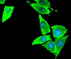 Coagulation Factor III/Tissue Factor Antibody (SN20-16), Novus Biologicals:Antibodies:Primary