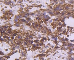 Coagulation Factor III/Tissue Factor Antibody (SN20-16), Novus Biologicals:Antibodies:Primary