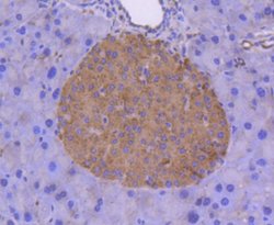Coagulation Factor III/Tissue Factor Antibody (SN20-16), Novus Biologicals:Antibodies:Primary