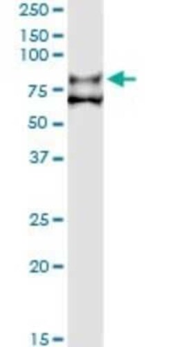 Coagulation Factor XI Antibody (2H8), Novus Biologicals 0.1 mg | Buy Online | Novus Biologicals | Fisher Scientific
