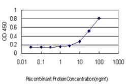 Coagulation Factor XI Antibody (2H8), Novus Biologicals 0.1 mg | Buy Online | Novus Biologicals | Fisher Scientific