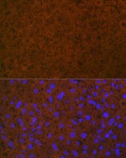 Coagulation Factor XIV/Protein C Rabbit anti-Human, Mouse, Rat, Clone: