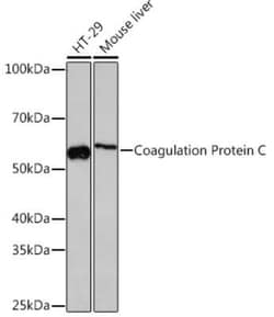 Coagulation Factor XIV/Protein C Rabbit anti-Human, Mouse, Rat, Clone: