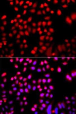 Cofilin 2 Antibody - BSA Free, Novus Biologicals 0.1 mL, Unconjugated:Antikörper