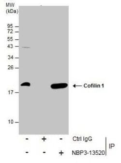 Cofilin Antibody (GT217), Novus Biologicals 100 &mu;g; Unconjugated:Antibodies,