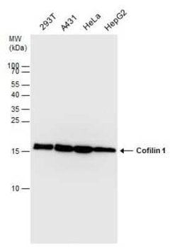 Cofilin Antibody (GT217), Novus Biologicals 100 &mu;g; Unconjugated:Antibodies,