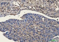 Cofilin Rabbit anti-Human, Mouse, Rat, Clone: S06-2C0, Novus Biologicals