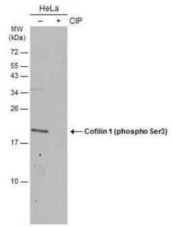 Cofilin, p Ser3 Antibody, Novus Biologicals 100 &mu;g; Unconjugated:Antibodies,
