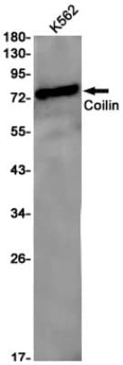Coilin Antibody (S02-4B9), Novus Biologicals:Antibodies:Primary Antibodies
