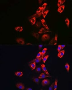 Collagen I alpha 1 Antibody - Azide and BSA Free, Novus Biologicals:Antibodies:Primary