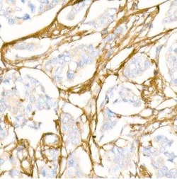 Collagen I alpha 1 Antibody - Azide and BSA Free, Novus Biologicals:Antibodies:Primary