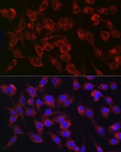 Collagen III alpha 1/COL3A1 Rabbit anti-Human, Mouse, Rat, Clone: 6Y9C6,