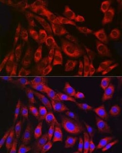 Collagen III alpha 1/COL3A1 Rabbit anti-Human, Mouse, Rat, Clone: 6Y9C6,