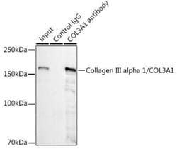Collagen III alpha 1/COL3A1 Rabbit anti-Human, Mouse, Rat, Clone: 6Y9C6,