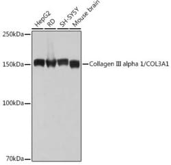Collagen III alpha 1/COL3A1 Rabbit anti-Human, Mouse, Rat, Clone: 6Y9C6,