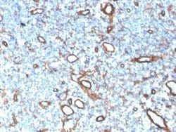 Collagen IV Antibody (COL4/4241R) - Azide and BSA Free, Novus Biologicals