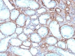 Collagen IV Mouse anti-Human, Clone: rCOL4/4742, Novus Biologicals 20 &mu;g;