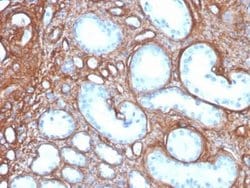 Collagen IV Mouse anti-Human, Clone: rCOL4/4742, Novus Biologicals 20 &mu;g;