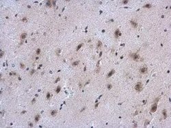 Collagen IV alpha 1 Antibody, Novus Biologicals 100 &mu;g | Buy Online | Novus Biologicals | Fisher Scientific