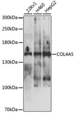 Collagen IV alpha5 Antibody - BSA Free, Novus Biologicals:Antibodies:Primary