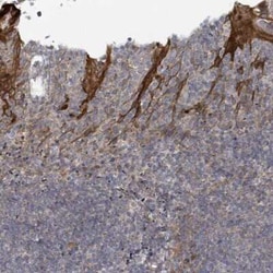 Collagen V alpha 3 Antibody, Novus Biologicals:Antibodies:Primary Antibodies