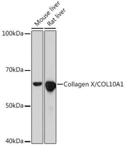 Collagen X alpha 1 Rabbit anti-Mouse, Rat, Clone: 0F5Q9, Novus Biologicals