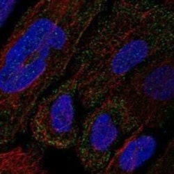 Collagen XII alpha1 Rabbit anti-Human, Polyclonal, Novus Biologicals:Antibodies:Primary