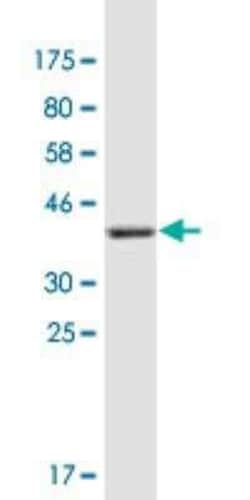 Collagen XXI Antibody (1G6), Novus Biologicals 0.1 mg | Buy Online | Novus Biologicals | Fisher Scientific