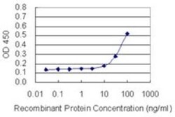 Collybistin/ARHGEF9 Antibody (3C11), Novus Biologicals 0.1 mg | Buy Online | Novus Biologicals | Fisher Scientific