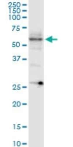 Collybistin/ARHGEF9 Antibody (3C11), Novus Biologicals 0.1 mg | Buy Online | Novus Biologicals | Fisher Scientific
