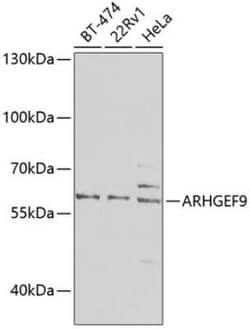 Collybistin/ARHGEF9 Antibody - BSA Free, Novus Biologicals 0.1 mL, Unconjugated:Antibodies,