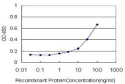 Complement C3 Antibody (5F9), Novus Biologicals 100 &mu;g;, Unconjugated:Antibodies,