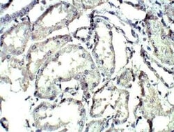 Complement C4 Antibody, Novus Biologicals 100 &mu;g | Buy Online | Novus Biologicals | Fisher Scientific