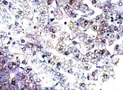 Complement C4 Antibody, Novus Biologicals 100 &mu;g | Buy Online | Novus Biologicals | Fisher Scientific