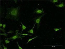 Complement C4b Antibody (1F2), Novus Biologicals 0.1 mg | Buy Online | Novus Biologicals | Fisher Scientific